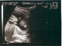 [Ultrasound Image 1]