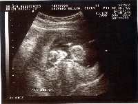 [Ultrasound Image 2]