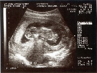 [Ultrasound Image 3]