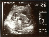 [Ultrasound Image 4]