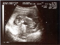 [Ultrasound Image 5]